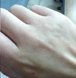 第十期:秋冬护手困扰j9国际站救救我的脸(图4) 第十期:秋冬护手困扰j9国际站救救我的脸(图4)